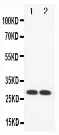 PRNP / PrP / Prion Antibody (aa144-160)