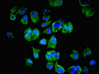 Polyclonal Rabbit anti-Human LSM4 Antibody (aa1-139, IHC, WB)