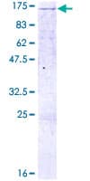 Human LLGL2 Protein (Recombinant GST)