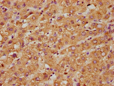 MPO / Myeloperoxidase Antibody