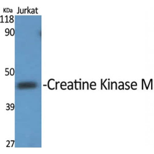 CKM / Creatine Kinase MM Antibody (10-90 aa, N-terminal)