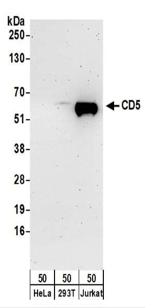 Polyclonal Rabbit anti-Human CD5 Antibody (aa445-495, WB)