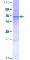Human WDR45L Protein (Recombinant GST)