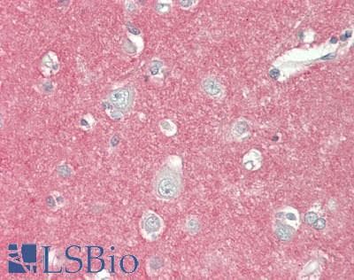 IHC-plus™ GNAO1 Antibody