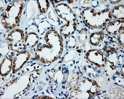 PLEK / Pleckstrin Antibody (clone OTI3E2)