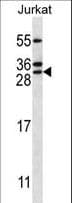 RAB5C Antibody (aa178-207)
