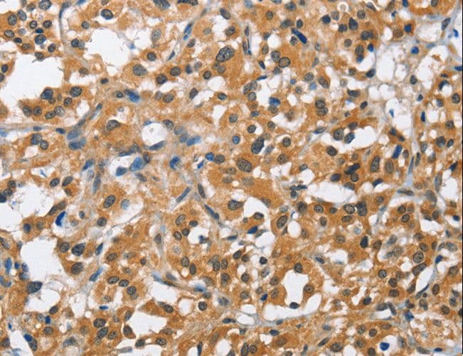 BCL10 / BCL-10 Antibody