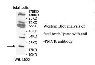 PMVK Antibody (aa14-191)