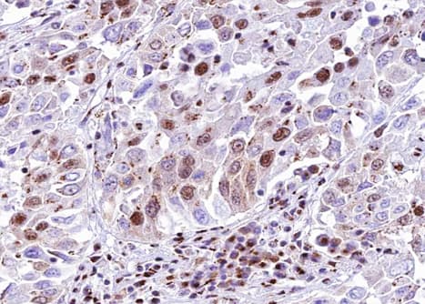 SMAD6 Antibody