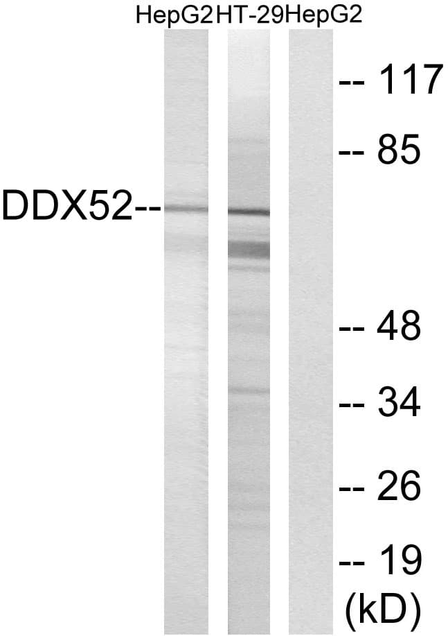 Polyclonal Rabbit anti-Human DDX52 Antibody (aa550-599, WB)