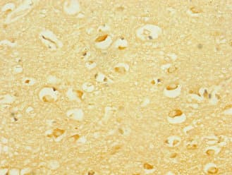 Polyclonal Rabbit anti-Human PCDH19 / Protocadherin 19 Antibody (IHC)