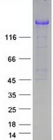Human UBE2O Protein (Recombinant Myc-DDK (Flag))
