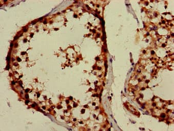 Polyclonal Rabbit anti-Human PPOX Antibody