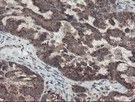 GCP60 / ACBD3 Antibody (clone OTI3A1)