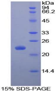 Dog IL1RN Protein (Recombinant His-S)
