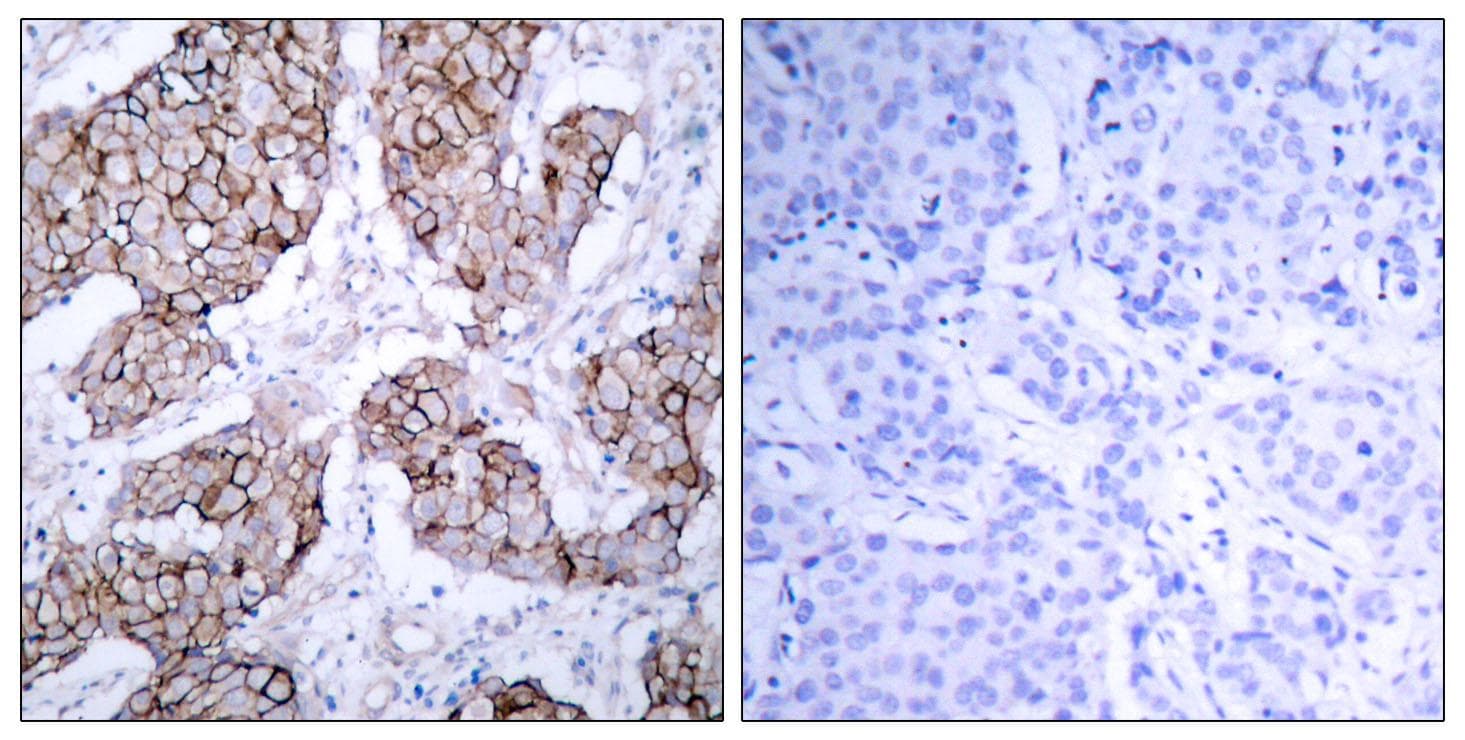 EGFR Antibody (phospho-Tyr1092)