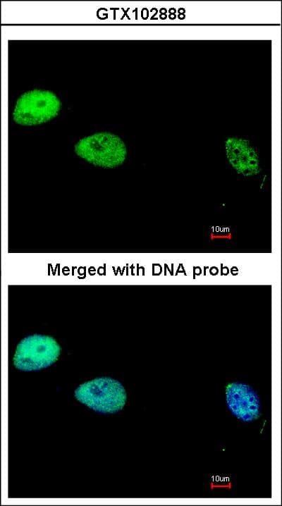 POLD1 Antibody (aa685-1071)
