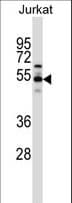 SKD1 / VPS4B Antibody (aa304-332)