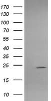 APCS / Serum Amyloid P / SAP Antibody (clone OTI1H2)
