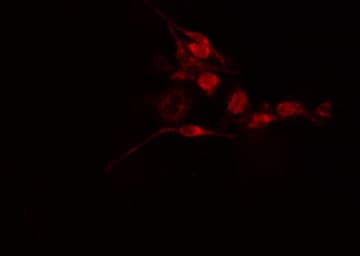 Polyclonal Rabbit anti-Human SEPT2 / Septin 2 Antibody (IF, WB)