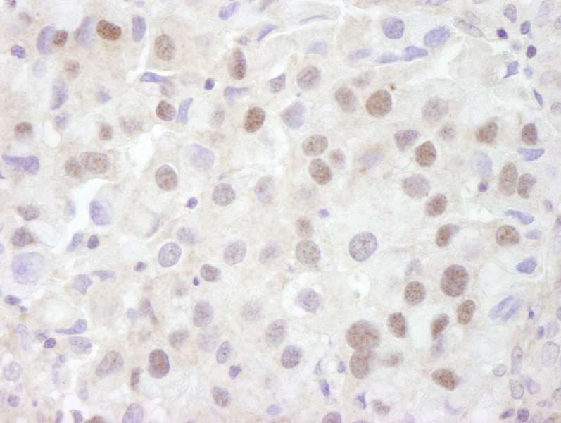 Prohibitin 2 / PHB2 Antibody (aa1-50)