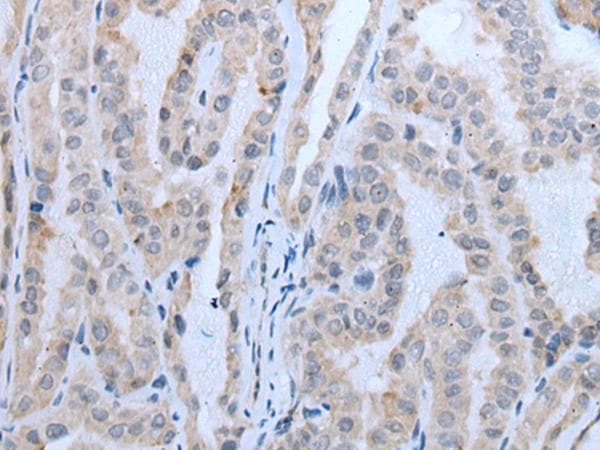 Polyclonal Rabbit anti-Human IMP-3 / IGF2BP3 Antibody (IHC, WB)