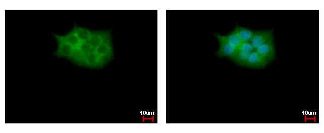 SKAP2 / SCAP2 Antibody (aa296-359)