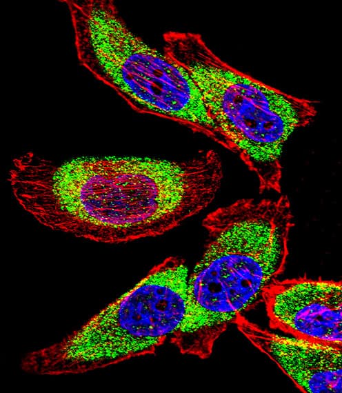 YBX1 / YB1 Antibody (aa276-305)