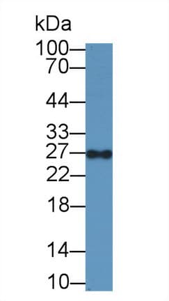 Geminin Antibody (aa1-209, PE)