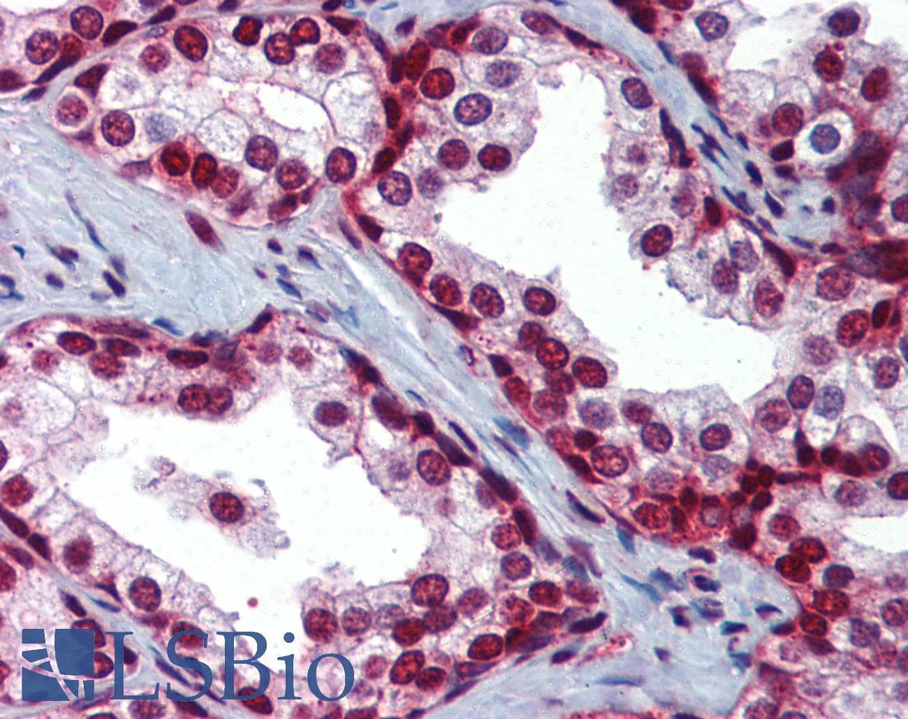 SLC35A5 Antibody (aa36-85)