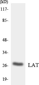 LAT Antibody (aa107-156)