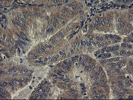 UBE2J1 Antibody (clone OTI3E6)