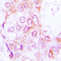 Polyclonal Rabbit anti-Human RSK1 + RSK2 + RSK3 Antibody (C-Terminus, IHC, IF, WB)