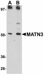 Polyclonal Rabbit anti-Human MATN3 / Matrilin 3 Antibody (WB)