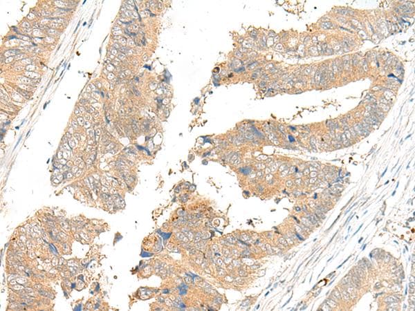 Polyclonal Rabbit anti-Human GLS2 / Glutaminase 2 Antibody (IHC, WB)