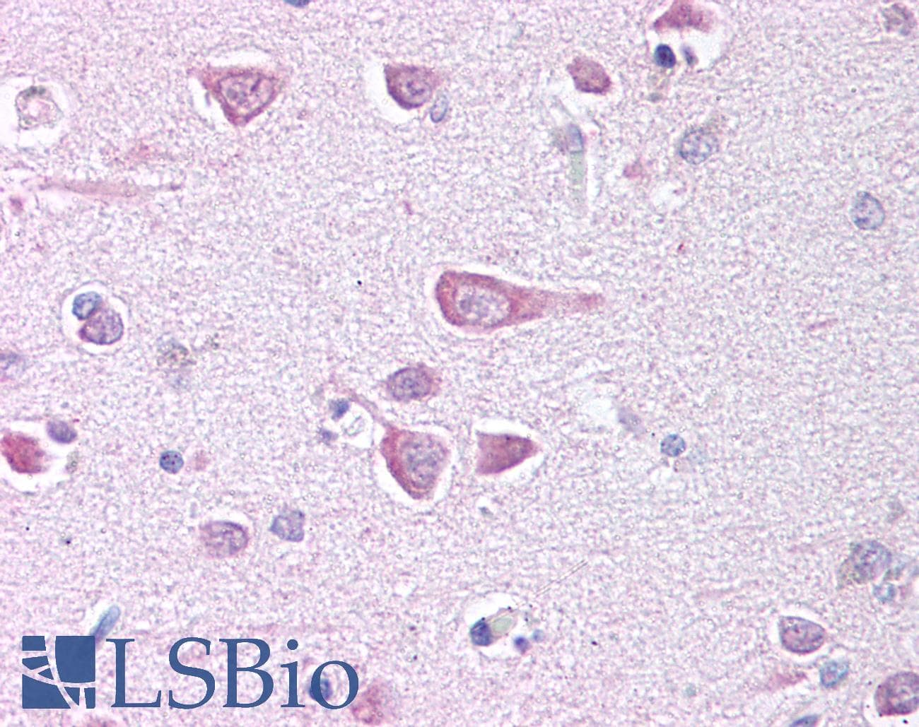 IHC-plus™ KIF2A Antibody (N-Terminus)