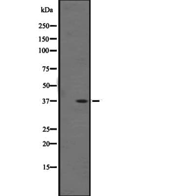 Polyclonal Rabbit anti-Human OR1F1 Antibody (IHC, WB)