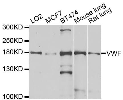 IHC-plus™ VWF / Von Willebrand Factor Antibody