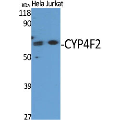 CYP4F2 Antibody (10-90 aa, N-terminal)
