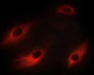 HSPB6 / HSP20 Antibody (phospho-Ser16)