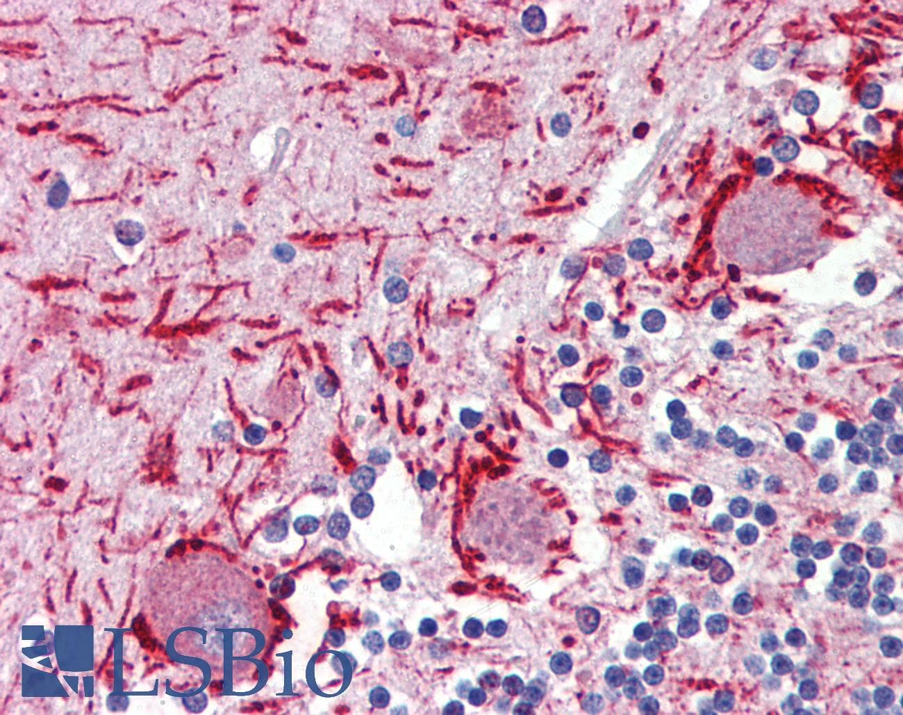 IHC-plus™ MEF2C Antibody (Ser396)
