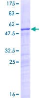 Human NUSAP1 / NUSAP Protein (Recombinant GST)