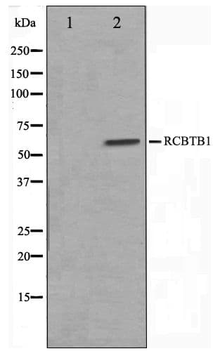 RCBTB1 Antibody