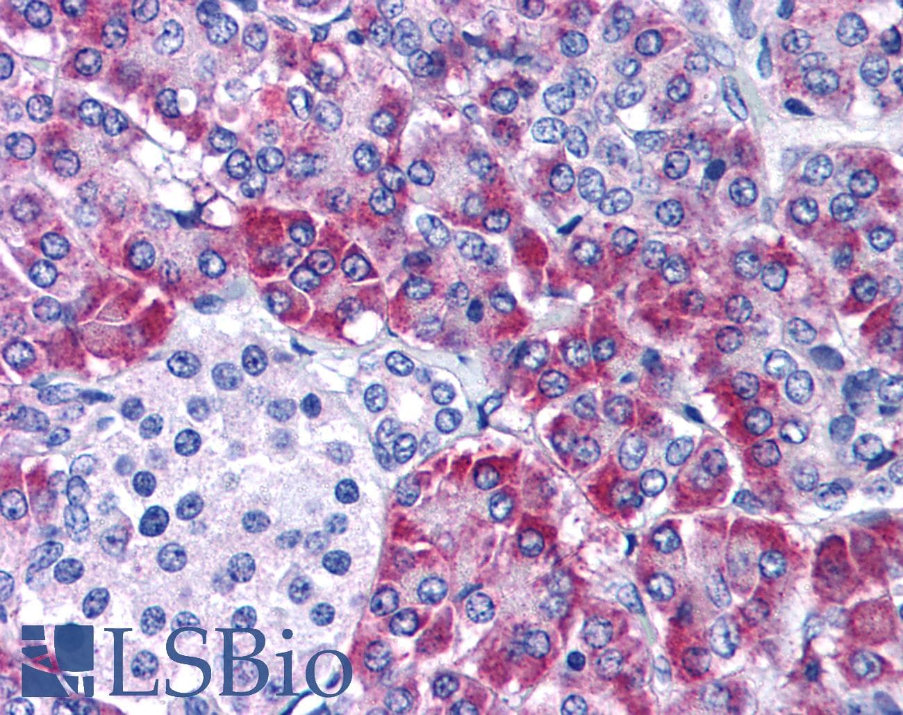 IHC-plus™ PMAIP1 / NOXA Antibody