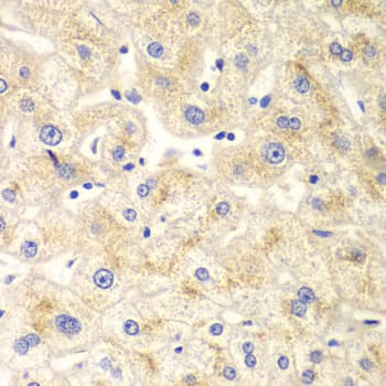 DNM1L / DRP1 Antibody