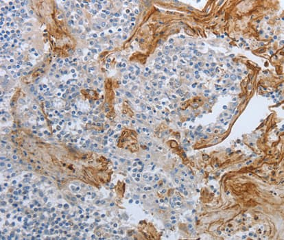 BRAF / B-Raf Antibody