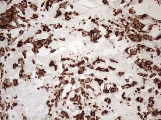 KRT16 / CK16 / Cytokeratin 16 Antibody (clone OTI2H8)