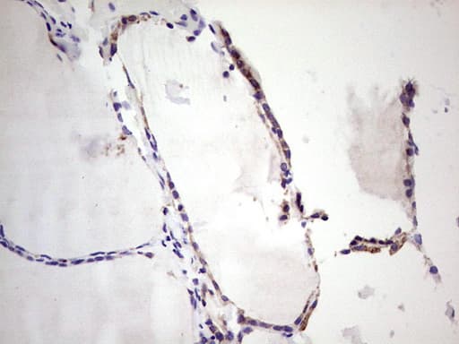 Peripherin Antibody (clone OTI3F4)