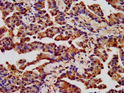 CHRNB3 Antibody