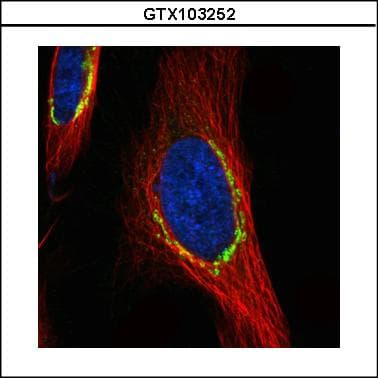 COPD / ARCN1 Antibody (aa89-511)